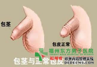 包茎术前术后注意问题