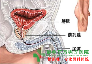 细菌性前列腺炎病因