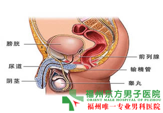 前列腺治疗