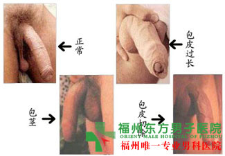 包皮红点