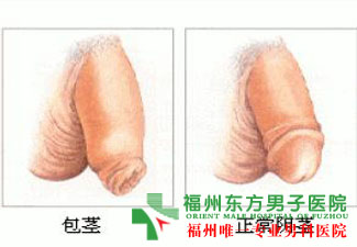 阴部瘙痒