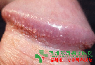 为何生殖器上有小疙瘩？严重吗