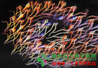 福州少精的原因是什么? 福州少精的原因是什么?