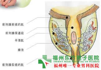 前列腺对性功能有哪些影响
