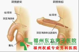 早泄的四大症状