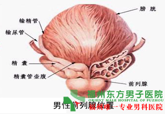 前列腺钙化手术