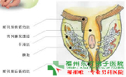 前列腺炎肥大图片?
