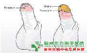 包皮咨询问题
