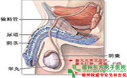 睾丸炎需要注意什么 睾丸炎需要注意什么