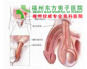 男性勃起图片